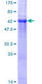 GJA4 / CX37 / Connexin 37 Protein - 12.5% SDS-PAGE of human GJA4 stained with Coomassie Blue