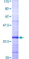 GJB1 / CX32 / Connexin 32 Protein - 12.5% SDS-PAGE Stained with Coomassie Blue.