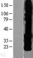 GJB2 / CX26 / Connexin 26 Protein - Western validation with an anti-DDK antibody * L: Control HEK293 lysate R: Over-expression lysate
