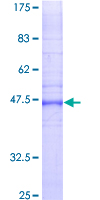 GJB2 / CX26 / Connexin 26 Protein - 12.5% SDS-PAGE of human GJB2 stained with Coomassie Blue