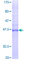GJB2 / CX26 / Connexin 26 Protein - 12.5% SDS-PAGE of human GJB2 stained with Coomassie Blue
