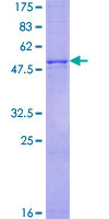 GJB3 / CX31 / Connexin 31 Protein - 12.5% SDS-PAGE of human GJB3 stained with Coomassie Blue