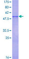 GJB3 / CX31 / Connexin 31 Protein - 12.5% SDS-PAGE of human GJB3 stained with Coomassie Blue