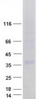 GJB3 / CX31 / Connexin 31 Protein - Purified recombinant protein GJB3 was analyzed by SDS-PAGE gel and Coomassie Blue Staining