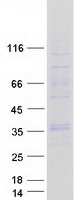 GJB4 / CX30.3 / Connexin 30.3 Protein - Purified recombinant protein GJB4 was analyzed by SDS-PAGE gel and Coomassie Blue Staining