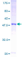 GJB5 / CX30.1 / Connexin 31.1 Protein - 12.5% SDS-PAGE of human GJB5 stained with Coomassie Blue