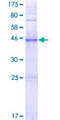 GJB7 / CX25 / Connexin 25 Protein - 12.5% SDS-PAGE of human GJB7 stained with Coomassie Blue