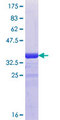 GJD2 / CX36 / Connexin 36 Protein - 12.5% SDS-PAGE Stained with Coomassie Blue.