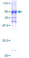 GK / Glycerol Kinase Protein - 12.5% SDS-PAGE of human GK stained with Coomassie Blue