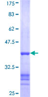 GK / Glycerol Kinase Protein - 12.5% SDS-PAGE Stained with Coomassie Blue.