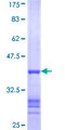 GK / Glycerol Kinase Protein - 12.5% SDS-PAGE Stained with Coomassie Blue.