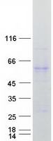 GK / Glycerol Kinase Protein - Purified recombinant protein GK was analyzed by SDS-PAGE gel and Coomassie Blue Staining
