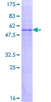 GK5 Protein - 12.5% SDS-PAGE of human MGC40579 stained with Coomassie Blue