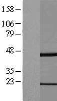 GKAP1 Protein - Western validation with an anti-DDK antibody * L: Control HEK293 lysate R: Over-expression lysate