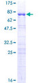 GKAP1 Protein - 12.5% SDS-PAGE of human GKAP1 stained with Coomassie Blue
