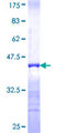 GKAP1 Protein - 12.5% SDS-PAGE Stained with Coomassie Blue.