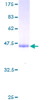 GKN1 / Gastrokine 1 Protein - 12.5% SDS-PAGE of human GKN1 stained with Coomassie Blue