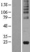 GKN2 / Gastrokine 2 Protein - Western validation with an anti-DDK antibody * L: Control HEK293 lysate R: Over-expression lysate