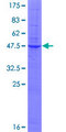 GKN2 / Gastrokine 2 Protein - 12.5% SDS-PAGE of human GDDR stained with Coomassie Blue