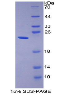 GKN2 / Gastrokine 2 Protein - Recombinant Gastrokine 2 By SDS-PAGE