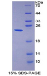 GKN2 / Gastrokine 2 Protein - Recombinant Gastrokine 2 By SDS-PAGE