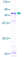 GLA / Alpha Galactosidase Protein - 12.5% SDS-PAGE of human GLA stained with Coomassie Blue