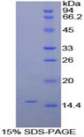 GLA / Alpha Galactosidase Protein - Recombinant Galactosidase Alpha By SDS-PAGE