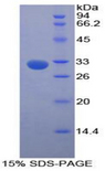 GLA / Alpha Galactosidase Protein - Recombinant Galactosidase Alpha By SDS-PAGE