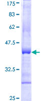GLB1 / Beta-Galactosidase Protein - 12.5% SDS-PAGE Stained with Coomassie Blue.