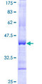 GLB1 / Beta-Galactosidase Protein - 12.5% SDS-PAGE Stained with Coomassie Blue.