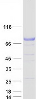 GLB1 / Beta-Galactosidase Protein - Purified recombinant protein GLB1 was analyzed by SDS-PAGE gel and Coomassie Blue Staining