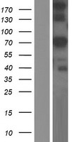 GLB1L Protein - Western validation with an anti-DDK antibody * L: Control HEK293 lysate R: Over-expression lysate