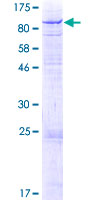 GLB1L Protein - 12.5% SDS-PAGE of human GLB1L stained with Coomassie Blue