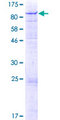 GLB1L Protein - 12.5% SDS-PAGE of human GLB1L stained with Coomassie Blue