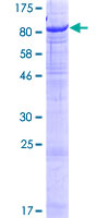 GLB1L2 Protein - 12.5% SDS-PAGE of human LOC89944 stained with Coomassie Blue