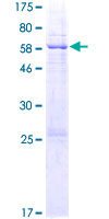 GLB1L3 Protein - 12.5% SDS-PAGE of human GLB1L3 stained with Coomassie Blue