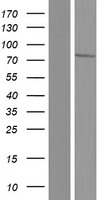 GLCNE / GNE Protein - Western validation with an anti-DDK antibody * L: Control HEK293 lysate R: Over-expression lysate
