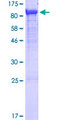 GLCNE / GNE Protein - 12.5% SDS-PAGE of human GNE stained with Coomassie Blue