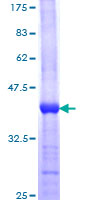 GLCNE / GNE Protein - 12.5% SDS-PAGE Stained with Coomassie Blue.