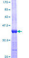 GLCNE / GNE Protein - 12.5% SDS-PAGE Stained with Coomassie Blue.