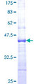 GLDN / Gliomedin Protein - 12.5% SDS-PAGE Stained with Coomassie Blue.