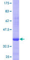 GLE1 Protein - 12.5% SDS-PAGE Stained with Coomassie Blue.