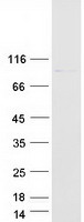 GLE1 Protein - Purified recombinant protein GLE1 was analyzed by SDS-PAGE gel and Coomassie Blue Staining