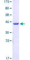 GLI / GLI1 Protein - 12.5% SDS-PAGE Stained with Coomassie Blue.
