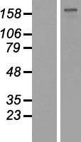 GLI2 Protein - Western validation with an anti-DDK antibody * L: Control HEK293 lysate R: Over-expression lysate