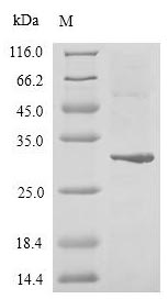 GLI2 Protein - (Tris-Glycine gel) Discontinuous SDS-PAGE (reduced) with 5% enrichment gel and 15% separation gel.