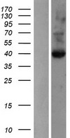 GLIPR1 / GLIPR Protein - Western validation with an anti-DDK antibody * L: Control HEK293 lysate R: Over-expression lysate