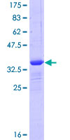 GLIPR1 / GLIPR Protein - 12.5% SDS-PAGE Stained with Coomassie Blue.