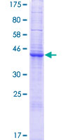 GLIPR1L1 Protein - 12.5% SDS-PAGE of human GLIPR1L1 stained with Coomassie Blue