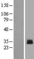 GLIPR1L2 Protein - Western validation with an anti-DDK antibody * L: Control HEK293 lysate R: Over-expression lysate